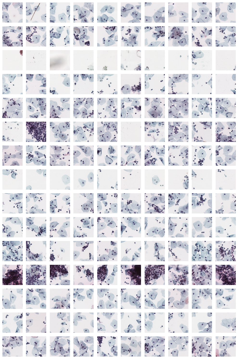 Example of cytology tiles we would like to extract features from.
